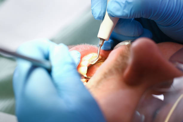 Best Emergency Dental Care for Broken or Chipped Teeth in Boonville, NC