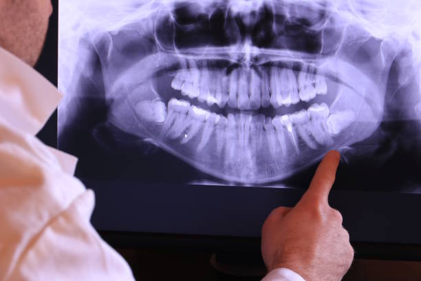 Best Emergency Tooth Extraction in Boonville, NC