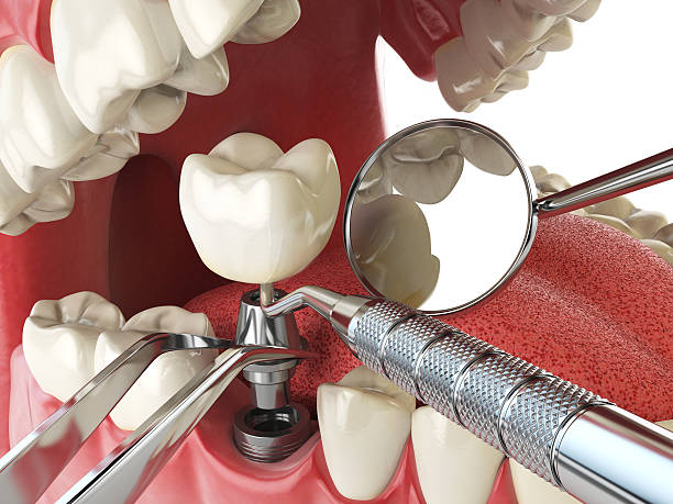 Best Same-Day Emergency Dental Services in Boonville, NC